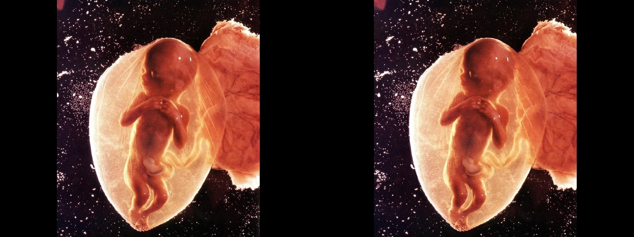 Embryon âgé de 18 semaines (18 week embryo) - 4°